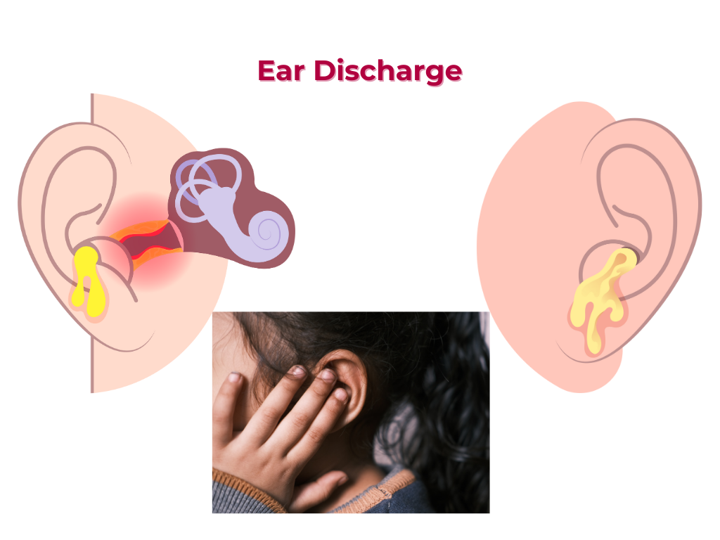 ear discharge