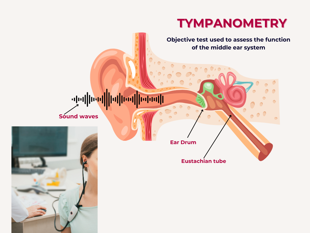 TYMPANOMETRY
